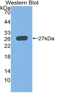 Polyclonal Antibody to Islet Cell Autoantigen 1 (ICA1)