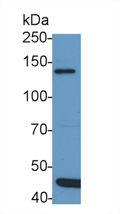 Polyclonal Antibody to Insulin Receptor Substrate 1 (IRS1)