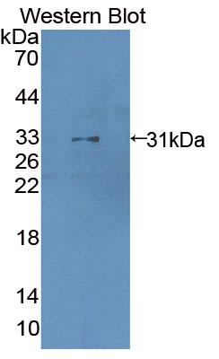 Polyclonal Antibody to Leucine Zipper, Down Regulated In Cancer 1 (LDOC1)