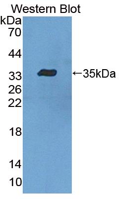 Polyclonal Antibody to Lymphocyte Specific Protein 1 (LSP1)