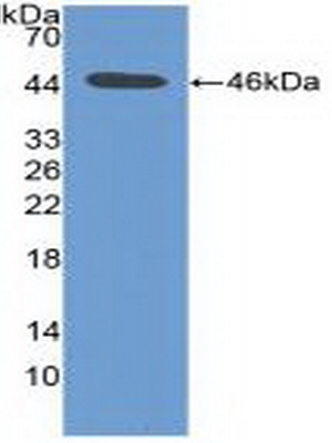 Polyclonal Antibody to Pim-1 Oncogene (PIM1)