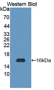 Polyclonal Antibody to Pim-1 Oncogene (PIM1)