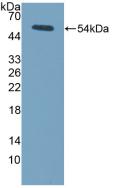 Polyclonal Antibody to Lysyl Oxidase (LOX)