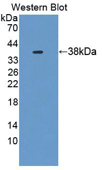 Polyclonal Antibody to Ubiquitin Associated Protein 1 (UBAP1)