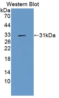 Polyclonal Antibody to Uridine Cytidine Kinase 2 (UCK2)