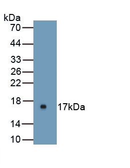 Polyclonal Antibody to Uroplakin 1A (UPK1A)