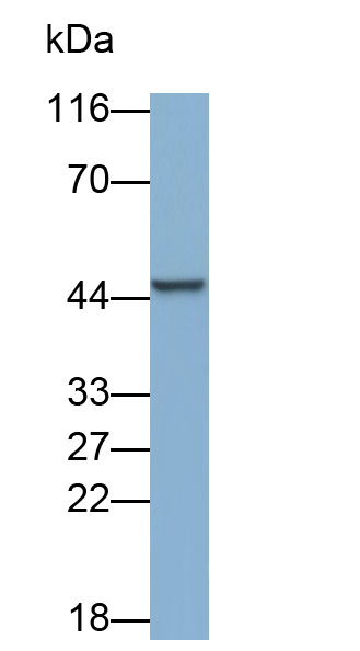 Polyclonal Antibody to Vaccinia Related Kinase 1 (VRK1)