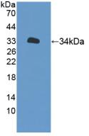 Polyclonal Antibody to Xylosyltransferase II (XYLT2)