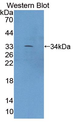 Polyclonal Antibody to Xylosyltransferase II (XYLT2)