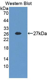 Polyclonal Antibody to YY1 Associated Factor 2 (YAF2)