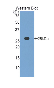 Polyclonal Antibody to 3-Mercaptopyruvate Sulfurtransferase (MST)