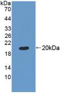 Polyclonal Antibody to Mitochondrial Ribosomal Protein L1 (MRPL1)