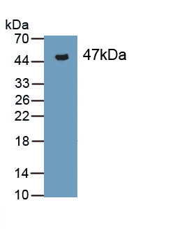 Polyclonal Antibody to Microsomal Triglyceride Transfer Protein (MTTP)