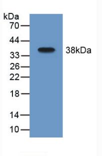 Polyclonal Antibody to Monoamine Oxidase B (MAOB)