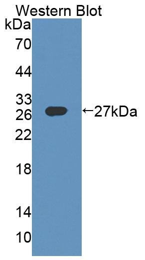 Polyclonal Antibody to Dystrophia Myotonica Protein Kinase (DMPK)