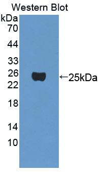 Polyclonal Antibody to Myocyte Specific Enhancer Factor 2A (MEF2A)