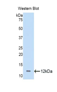 Polyclonal Antibody to Nucleophosmin 1 (NPM1)