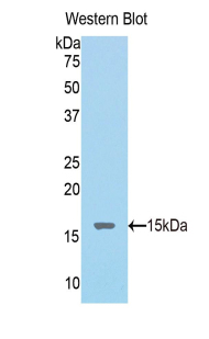 Polyclonal Antibody to Nucleophosmin 1 (NPM1)