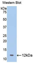 Polyclonal Antibody to 2',5'-Oligoadenylate Synthetase 1 (OAS1)