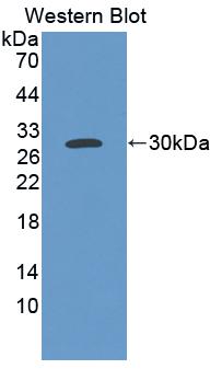 Polyclonal Antibody to Osteosarcoma Amplified 9 (OS9)