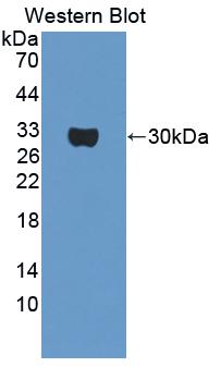 Polyclonal Antibody to Osteosarcoma Amplified 9 (OS9)