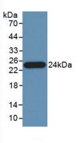 Polyclonal Antibody to Pancreas Specific Transcription Factor 1a (PTF1a)