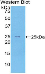 Polyclonal Antibody to Peripheral Myelin Protein 22 (PMP22)