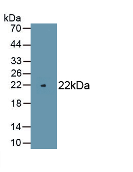 Polyclonal Antibody to Peripheral Myelin Protein 22 (PMP22)