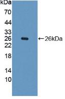 Polyclonal Antibody to Phenylalanine Hydroxylase (PAH)