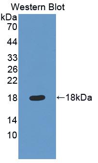 Polyclonal Antibody to Quiescin Q6 Sulfhydryl Oxidase 1 (QSOX1)