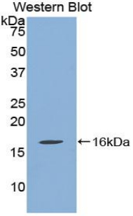 Polyclonal Antibody to Quiescin Q6 Sulfhydryl Oxidase 1 (QSOX1)