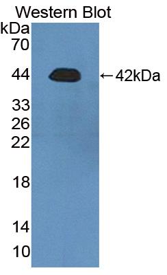 Polyclonal Antibody to Rhotekin (RTKN)