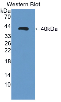 Polyclonal Antibody to Retinaldehyde Binding Protein 1 (RLBP1)