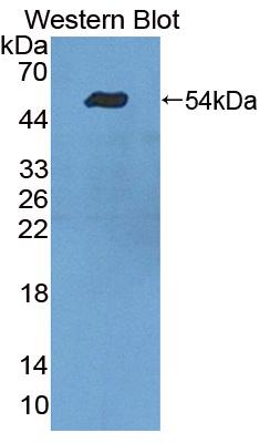 Polyclonal Antibody to Tyrosyl DNA Phosphodiesterase 1 (TDP1)