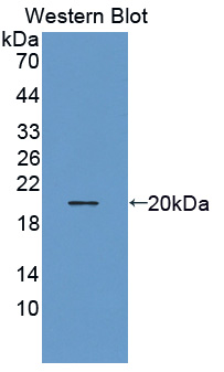 Polyclonal Antibody to Thyroid Hormone Responsive (THRSP)