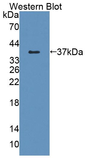 Polyclonal Antibody to Transmembrane Protein 1 (TMEM1)