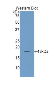 Polyclonal Antibody to Tetraspanin 3 (TSPAN3)