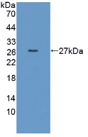 Polyclonal Antibody to Thiopurine Methyltransferase (TPMT)