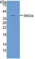 Polyclonal Antibody to Tripeptidyl Peptidase I (TPP1)