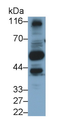 PAC842Hu03.jpg