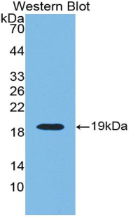 Polyclonal Antibody to Renalase (RNLS)