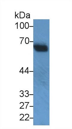 Polyclonal Antibody to Snurportin 1 (SNUPN1)