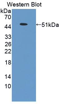 Polyclonal Antibody to Sclerostin (SOST)