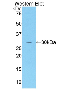 Polyclonal Antibody to Sulfatase Modifying Factor 1 (SUMF1)