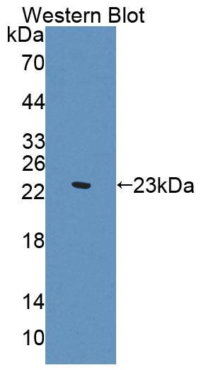 Polyclonal Antibody to Supervillin (SVIL)