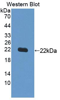 Polyclonal Antibody to Supervillin (SVIL)