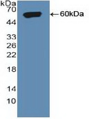 Polyclonal Antibody to Sortilin 1 (SORT1)