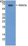 Polyclonal Antibody to Deiodinase, Iodothyronine, Type II (DIO2)