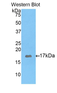 Polyclonal Antibody to Glutamate Decarboxylase 1, Brain (GAD1)