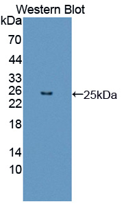 PAC914Hu01.jpg